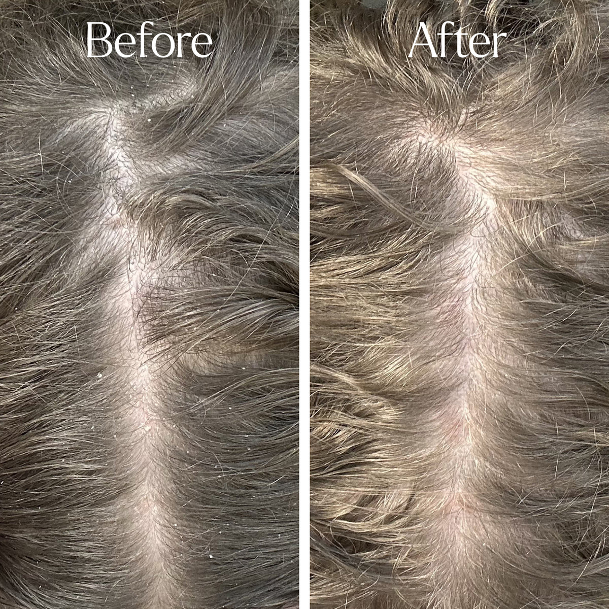 Only Curls Curl Detox Clarifying Shampoo